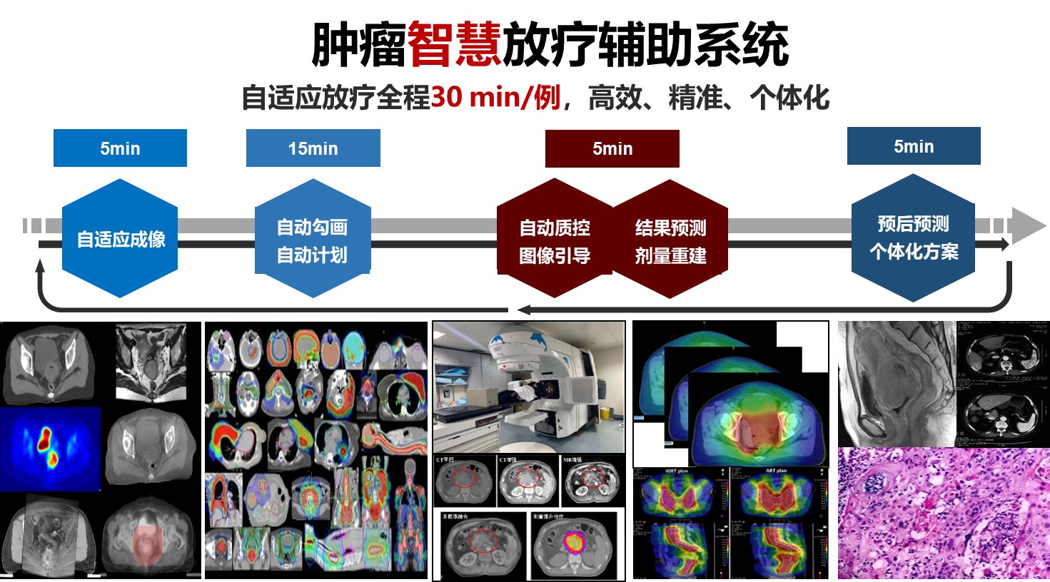 肿瘤智慧放疗辅助系统